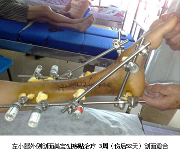GA黄金甲(中国)最新官方网站
