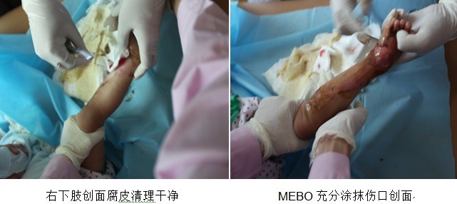 201210523753839