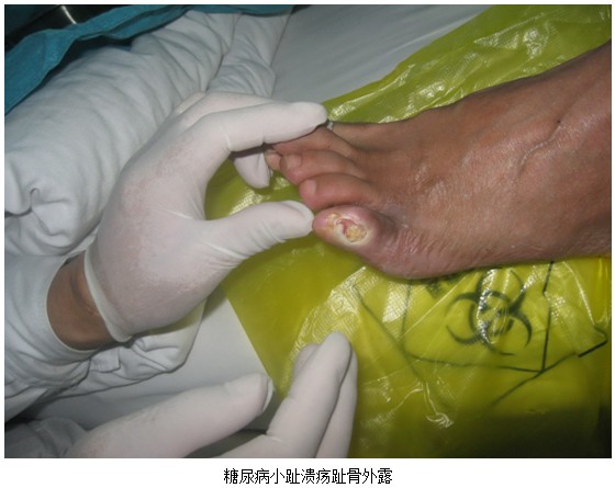 2012611133356888